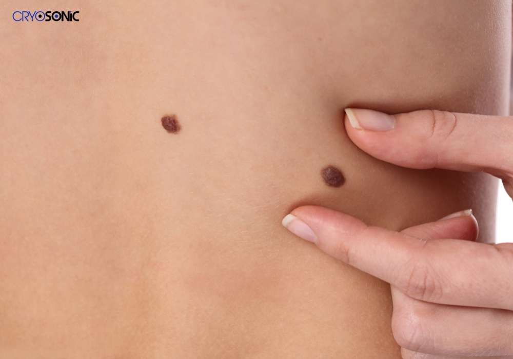 Infection Risk and Poor Aftercare Wakefield