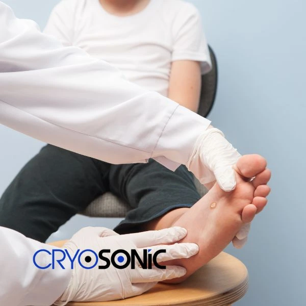 Are you looking for fast effective wart removal Contact us today Wakefield