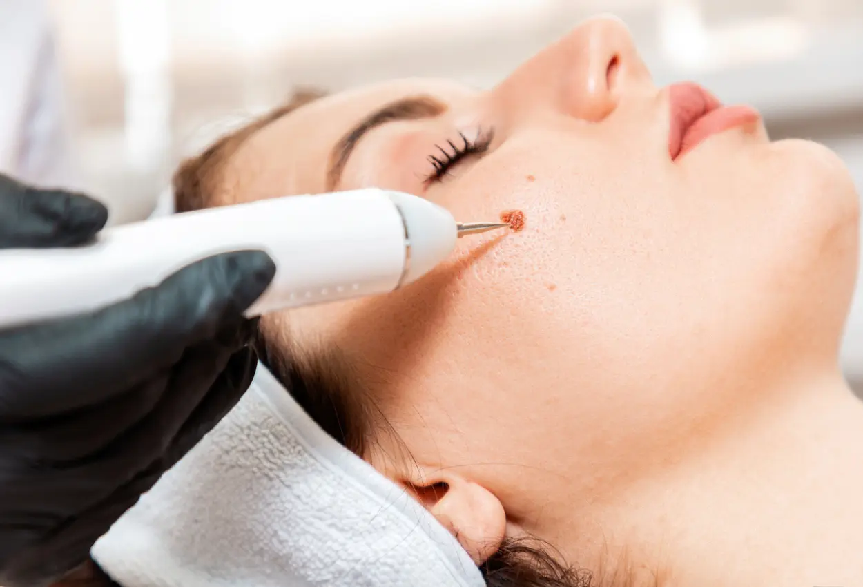 Frequently Asked Questions About Multiple Cryotherapy Treatments Wakefield