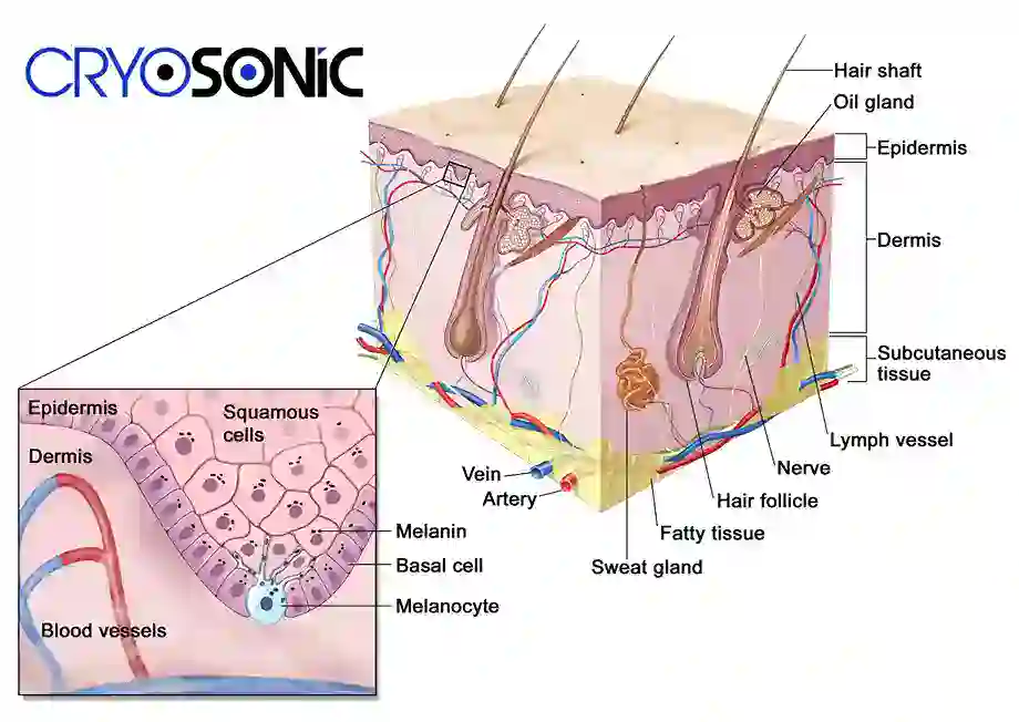 How Cryotherapy Stimulates Melanocyte Activity Wakefield